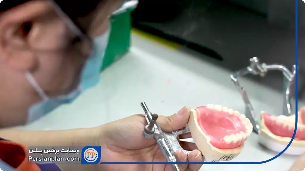 فرایند تولید دندان مصنوعی در کارخانه_پرشین پلن